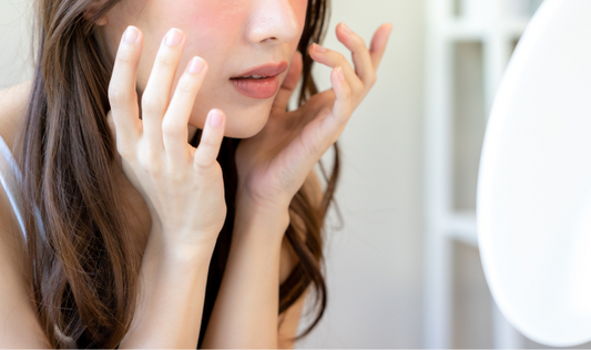 それってもしかして「花粉皮膚炎」かも?症状をチェックしてみよう